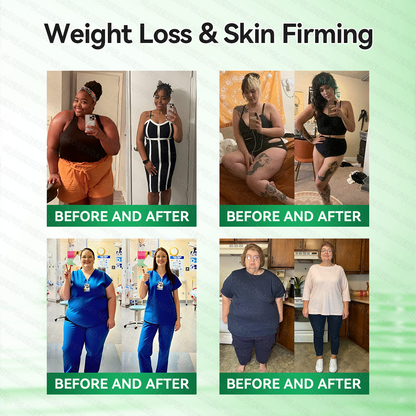 𝑶𝒇𝒇𝒊𝒄𝒊𝒂𝒍 𝑺𝒕𝒐𝒓𝒆  | 💖💖 𝐂𝐚𝐫𝐞𝐔𝐩𝐥𝐢𝐟𝐭® 𝙈𝒐𝒓𝒊𝒏𝒈𝗮 · 𝗕𝗲𝗿𝗯𝐞𝐫𝐢𝐧𝙚 × 𝙉𝑨𝑫+ 𝟏𝟎-𝙞𝙣-𝟏 𝘼𝒅𝒗𝒂𝒏𝒄𝒆𝐝 𝐍𝐚𝐧𝙤 𝙈𝙞𝙘𝙧𝙤𝙣𝒆𝒆𝒅𝒍𝐞 𝐏𝐚𝐭𝙘𝙝(𝐉𝐮𝐬𝐭 𝐨𝐧𝐜𝐞 𝐚 𝐝𝐚𝐲, 𝐯𝐢𝐬𝐢𝐛𝐥𝐞 𝐜𝐡𝐚𝐧𝐠𝐞𝐬 𝐢𝐧 𝟕 𝐝𝐚𝐲𝐬） ✅ 𝐅𝐨𝐫 𝐨𝐛𝐞𝐬𝐢𝐭𝐲, 🅛🅞🅞🅢🅔 🅢🅚🅘🅝,𝐝𝐢𝐚𝐛𝐞𝐭𝐞𝐬, 𝐬𝐥𝐞𝐞𝐩 𝐚𝐩𝐧𝐞𝐚, 𝐣𝐨𝐢𝐧𝐭 𝐢𝐬𝐬𝐮𝐞𝐬, 𝐚𝐧𝐝 𝐦𝐨𝐫𝐞