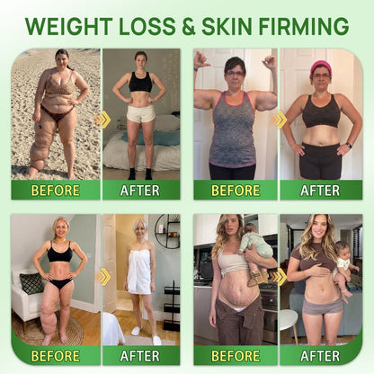 30𝑶𝒇𝒇𝒊𝒄𝒊𝒂𝒍 𝑺𝒕𝒐𝒓𝒆 | 𝐍𝐞𝐰!🍀𝐂𝐚𝐫𝐞𝐔𝐩𝐥𝐢𝐟𝐭® 𝐁𝐫𝐨𝐰𝐧 𝐒𝐞𝐚𝐰𝐞𝐞𝐝× 𝐁𝐞𝐫𝐛𝐞𝐫𝐢𝐧𝐞× 𝐍𝐃𝐀+ 𝟏𝟎-𝐢𝐧-𝟏 𝐍𝐚𝐧𝐨 𝐌𝐢𝐜𝐫𝐨𝐧𝐞𝐞𝐝𝐥𝐞 𝐏𝐚𝐭𝐜𝐡(𝐉𝐮𝐬𝐭 𝐨𝐧𝐜𝐞 𝐚 𝐝𝐚𝐲, 𝐯𝐢𝐬𝐢𝐛𝐥𝐞 𝐜𝐡𝐚𝐧𝐠𝐞𝐬 𝐢𝐧 𝟕 𝐝𝐚𝐲𝐬）𝘽𝙚𝙧𝙗𝙚𝙧𝙞𝙣𝙚 + 𝐁𝐫𝐨𝐰𝐧 𝐒𝐞𝐚𝐰𝐞𝐞𝐝 𝙁𝙤𝙧𝙢𝙪𝙡𝙖 ✅ 𝐅𝐨𝐫 𝐨𝐛𝐞𝐬𝐢𝐭𝐲, 𝗟𝗼𝗼𝘀𝗲 𝘀𝗸𝗶𝗻,𝐝𝐢𝐚𝐛𝐞𝐭𝐞𝐬, 𝐬𝐥𝐞𝐞𝐩 𝐚𝐩𝐧𝐞𝐚, 𝐣𝐨𝐢𝐧𝐭 𝐢𝐬𝐬𝐮𝐞𝐬, 𝐚𝐧𝐝 𝐦𝐨𝐫𝐞💯💯（副本）